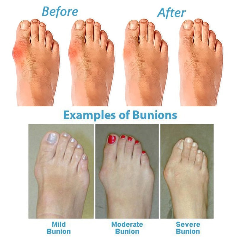 Women's Orthopedic Sandals